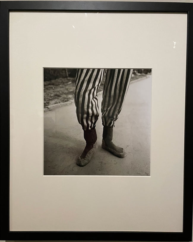 Untitled (The legs of a Buchenwald deportee), Buchenwald, 1945